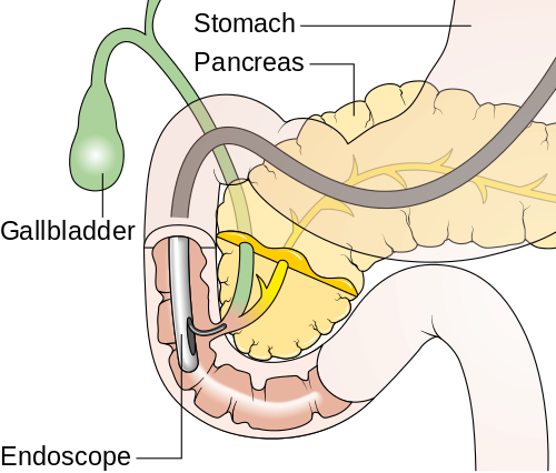Best ERCP Treatment in Mumbai