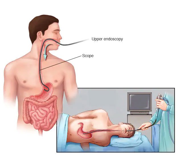 Advanced Gastroscopy for Accurate Diagnosis