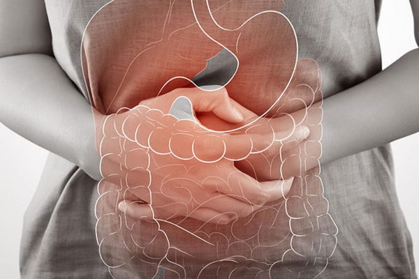 IBD