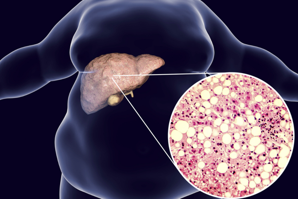 Best Liver Biopsy Procedure in Mumbai