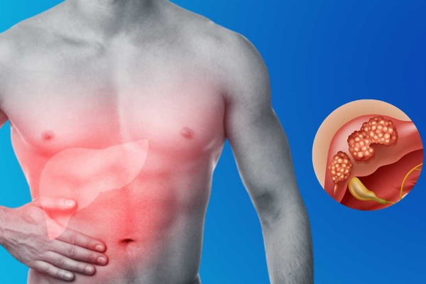 Best Liver Biopsy Procedure in Mumbai