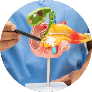 Pancreatic Cancer
