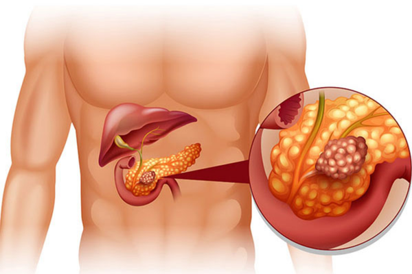 Best ERCP Treatment in Mumbai