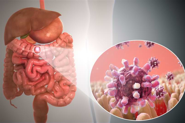 Gastrointestinal Cancers