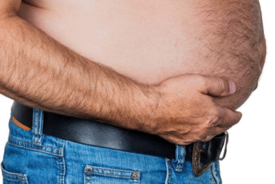 Portal Hypertension Management in Mumbai