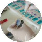 Stool Sample