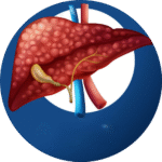 Liver Fibrosis
