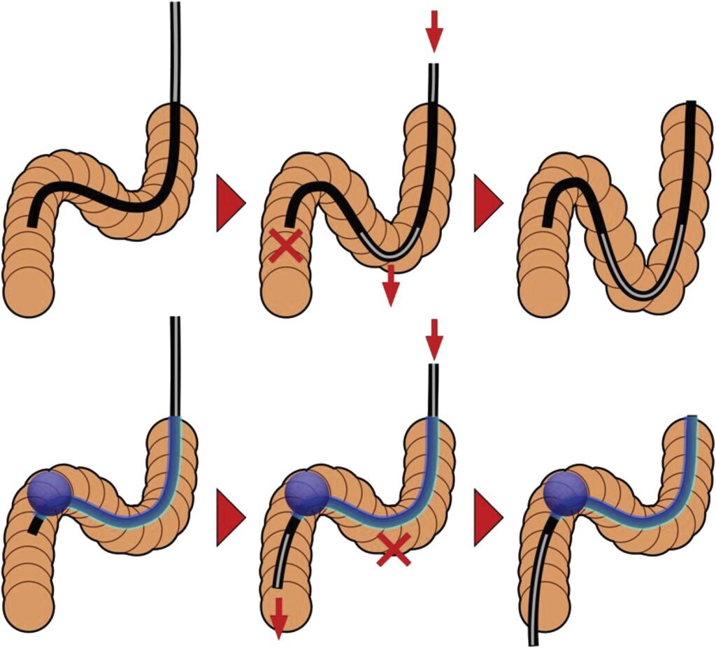 Balloon Enteroscopy Procedure in Mumbai