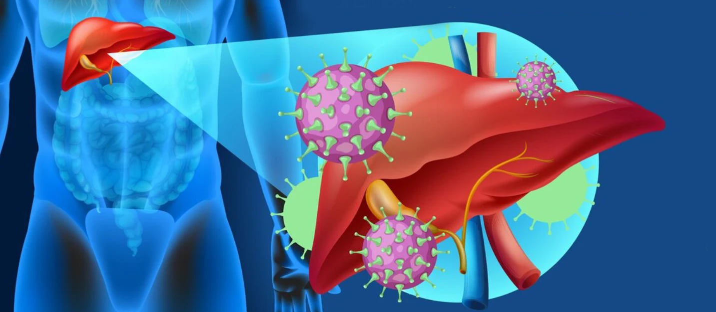Treatment for Acute Liver Failure in Mumbai