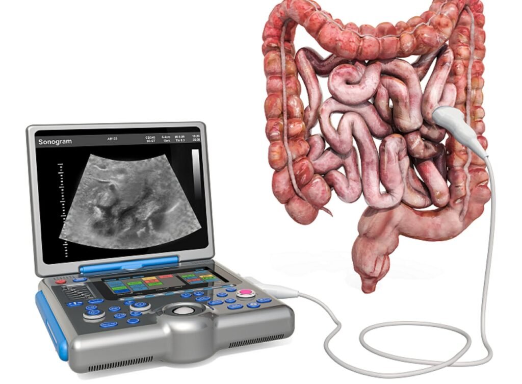 Intestinal Ultrasound Scan (IUS) in Mumbai