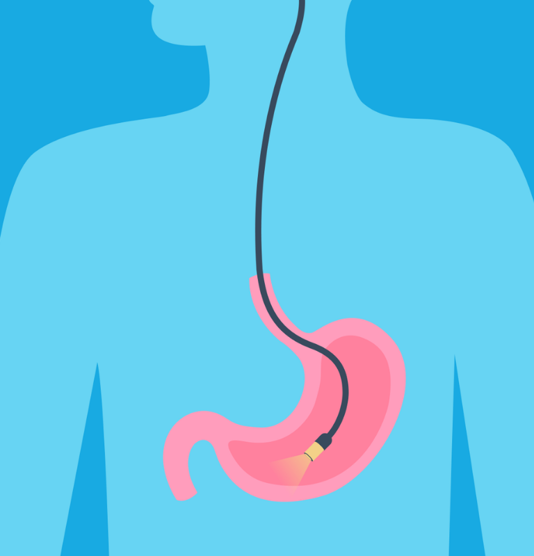 Gastroscopy