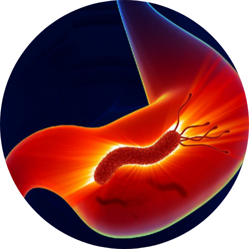 Stomach cancer