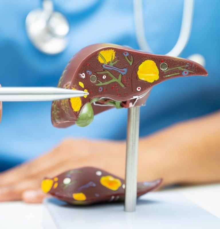 Acute liver Failure