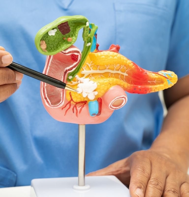 Pancreatitis