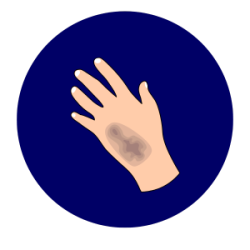 gastro categories – 2025-07-21T190905.129 Bruising