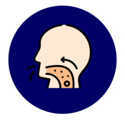 Regurgition
