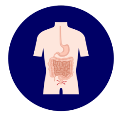 gastro categories (23) Perianal Discomfort
